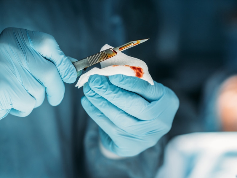 В Чечне похитили и до смерти избили хирурга, который провел неудачную операцию сестре соратника Кадырова