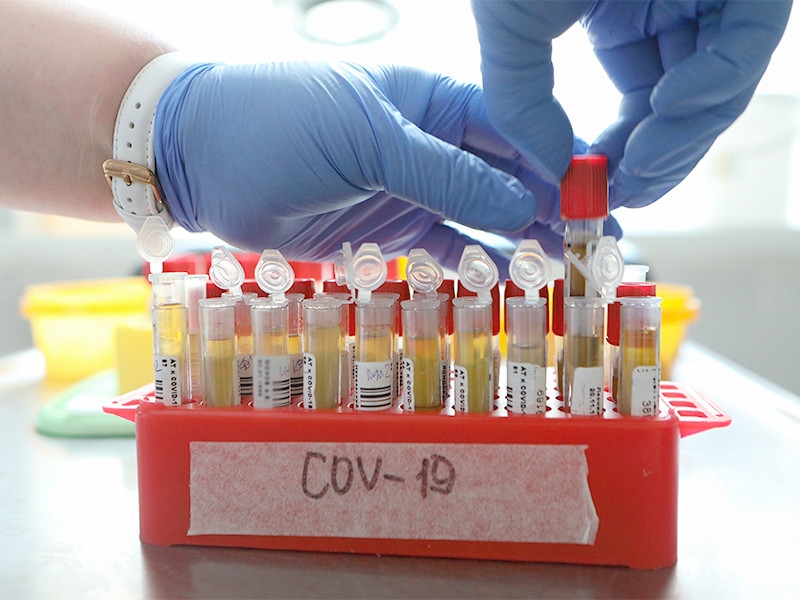 В России число случаев заболевания коронавирусом за сутки снова превысило 15 тысяч