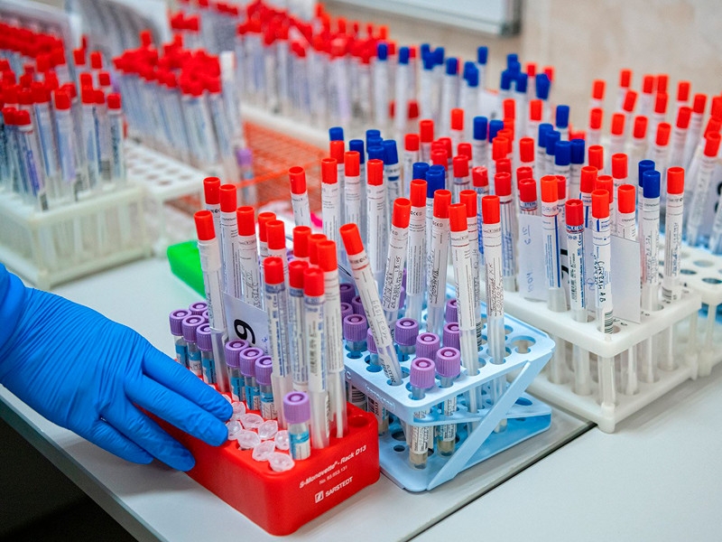 Роспотребнадзор приостановил работу двух московских клиник "Чайка", где скрывали результаты тестов на COVID-19