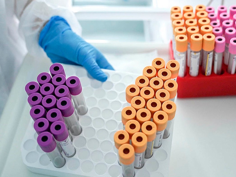 В России выявлено 18 648 новых случаев коронавируса, 355 человек умерли