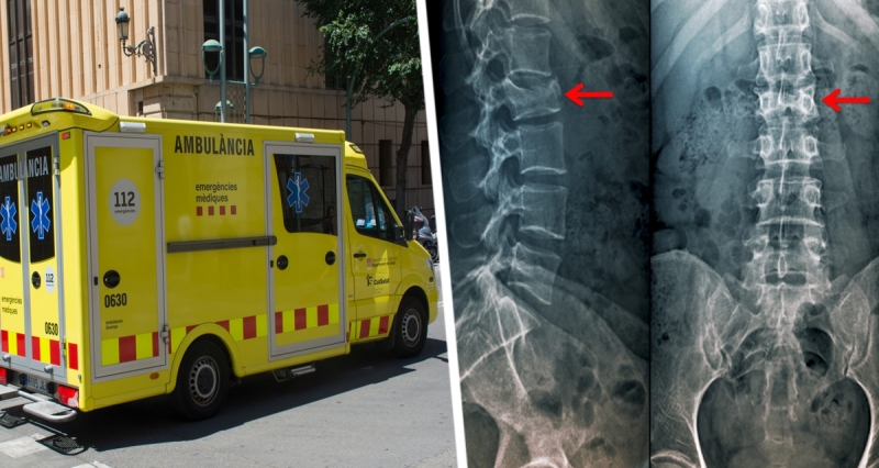 Отдых семьи превратился в «шоу ужасов» после того, как бабушка сломала сразу плечо и позвоночник, распаковывая чемоданы