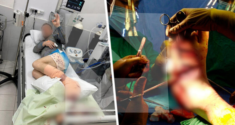 Акула напала на российского туриста, чуть не откусив ему ногу