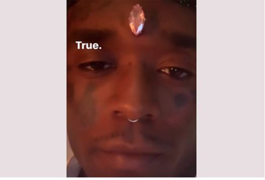 Американский рэпер имплантировал в лоб драгоценный камень