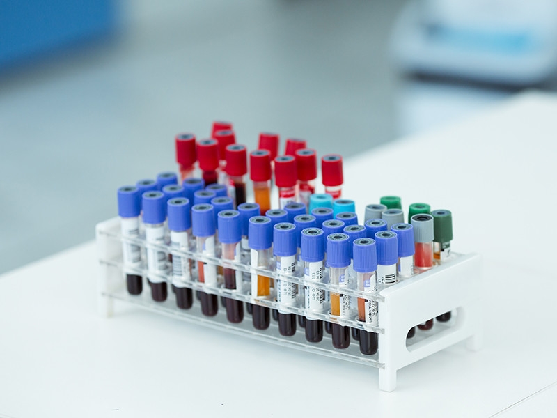 Трое футболистов сборной России сдали сомнительные тесты на COVID-19