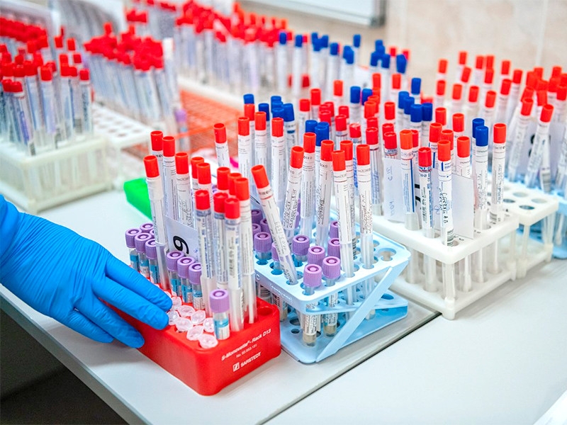 В России снова антирекорд - 18665 случаев заражения коронавирусом